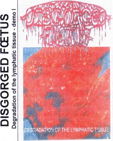 Disgorged Foetus – Degradation Of The Lymphatic Tissue (2000) Cassette Repress