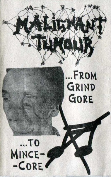 Malignant Tumour – …From Grind Gore …To Mince-Core (2022) Cassette